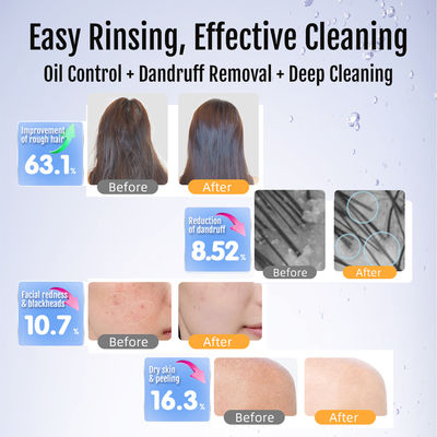 0.1-50 माइक्रोन बबल आकार के साथ अल्ट्रा फाइन बबल जनरेटर, 300% कीटनाशक अवशेष हटाने और 100 मिलियन बबल्स/एमएल डीप पोर क्लींजिंग के लिए